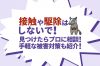 ハクビシンを見つけたら自分での駆除はダメ！近所で目撃したら被害対策を！