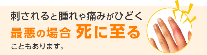 刺されると腫れや痛みがひどく最悪の場合死に至ることもあります。