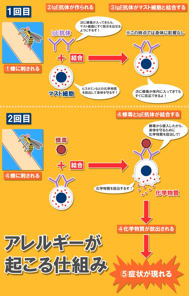 蜂毒でアレルギー反応が起こる流れ